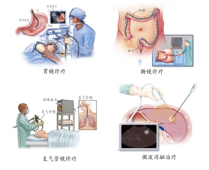 醫(yī)用內窺鏡介紹